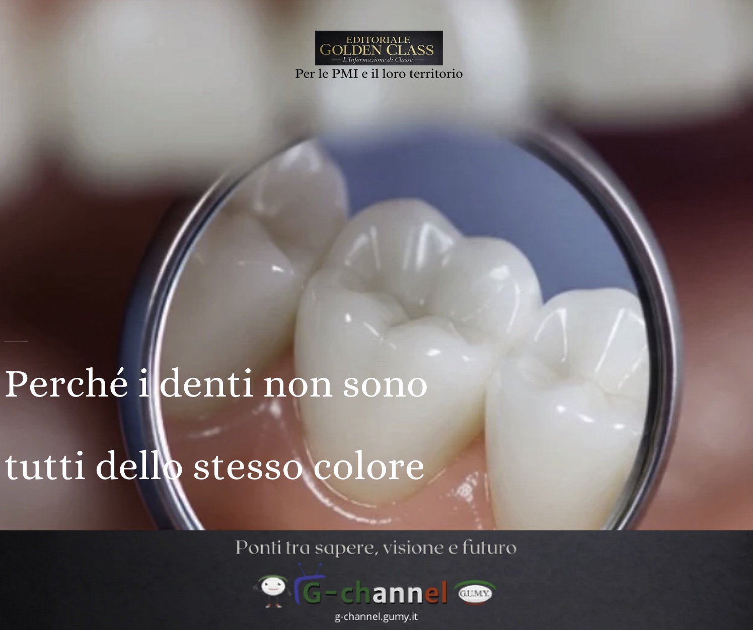 Perché i denti non sono tutti dello stesso colore